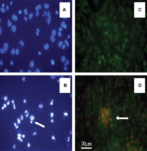 Figure 9. Fluorescence inverted microscopy image of SKMEL-30 carcinoma cells. (A) Nucleus of cells (stained with Hoescht 33342), where blue spots indicate nucleus of non-apoptotic cells as a control. (B) Shining and smashed nucleus (shown with arrow) of apoptotic cells in PCL-mPEG2000/PEI (N/P;9) containing medium. (C) Fluorescence microscopy image of cells (stained with Hoescht 33342), where formation of green cells demonstrates non-necrotic cells (photo taken under FITC filter) as a control. (D) Nucleus of SKMEL-30 cells (stained with PI and Hoescht 33342), where dense red spots indicate nucleus of necrotic cells and green cells indicate non-necrotic cells. Images were recorded with ×400 magnification. Photos A and B were taken under DAPI filter and C and D taken under FITC filter.