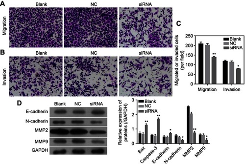 Figure 4 Knockdown of circLMNB1 suppressed the EMT of LoVo cells. (A, B) Transwell assays were performed to detect the migration and invasion of LoVo cells with circLMLB1 knockdown. (C) Expression of E-cadherin, N-cadherin, MMP2/9 were detected using Western blot. *P<0.05, **P<0.01 vs NC group.