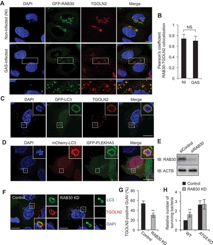 Figure 1. RAB30 is required for the recruitment of TGN-derived elements into GcAVs. (a) HeLa cells expressing EmGFP-RAB30 were infected with GAS for 3 h, fixed and immunostained with an anti-TGOLN2 antibody. (b) Pearson’s coefficient quantified for RAB30-TGOLN2 colocalization in noninfected (NI) or GAS-infected cells. Data represent means ± SD of 3 independent experiments (> 20 cells analyzed per condition). NS, not significant. (c) HeLa cells expressing EmGFP-LC3 were infected with GAS JRS4 for 4 h and fixed. After permeabilization, cells were stained using an anti-TGOLN2 antibody, and cellular and bacterial DNA was stained with DAPI. Images were captured using confocal microscopy. (d) HeLa cells expressing EmGFP-PLEKHA3, a resident of the TGN, were infected with GAS for 4 h. (e) HeLa cells transfected with a control siRNA or RAB30 siRNA were analyzed by immunoblotting. (f) HeLa cells were transfected with a control siRNA or RAB30 siRNA, as well as EmGFP-LC3 expression vector and then infected with GAS for 4 h. Cells were then fixed, permeabilized, and stained using an anti-TGOLN2 antibody. Bars: 10 μm. (g) Quantification of TGOLN2-positive GcAVs in control and RAB30 knockdown (KD) cells. Data represent the mean value ± SD from 3 independent experiments (> 50 GcAVs analyzed per condition). (h) HeLa WT or ATG5 knockout (KO) cells were transfected with a control siRNA or RAB30 siRNA. Two days after transfection, cells were infected with GAS for 2 and 6 h. The number of invading and surviving bacteria was measured in the GAS viability assay. *P < 0.05, **P < 0.01.