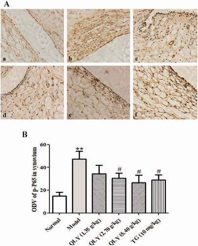 Figure 9. Effects of QLY granules on expression of p-P65 in synovial tissues. (A) Representative immunohistochemical analyses of p-P65 expression in the synovial tissues, illustrating alterations in the synovial tissues of each group of rats (magnification, ×400). a: normal; b: model; c: QLY granules (1.35 g/kg); d: QLY granules (2.70 g/kg); e: QLY granules (5.40 g/kg); f: TG (10 mg/kg). (B) ODVs of p-P65 in the synovial tissues markedly decreased in rats with AA following administration of QLY granules and TG. Data are expressed as the mean ± SD, with 3 samples in each group. **p < 0.01 vs. normal; #p < 0.05 vs. model.