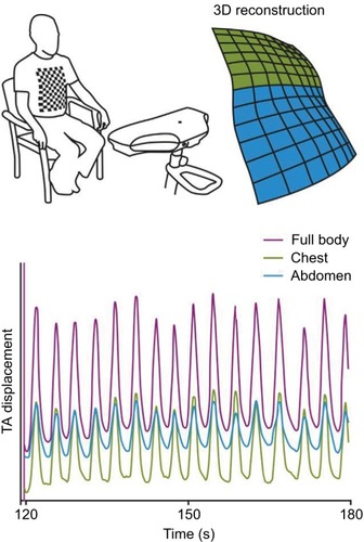 Figure 1 Working principle of SLP.