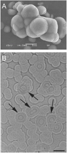 Figure 2. Images of apatite clusters, formed by nanobacteria under serum-free culture conditions, taken by (A) scanning electron microscope and (B) differential interference contrast microscope.