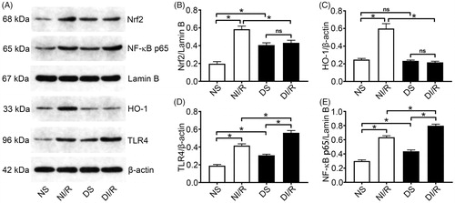 Figure 3. Diabetes blocks the Nrf2/HO-1 pathway and amplifies NF-κB signaling after I/R. (A) Representative western blotting images and quantification of protein levels of (B) Nrf2, (C) HO-1, (D) TLR4, and (E) NF-κB. The results are presented as mean ± SD. *p < .05.