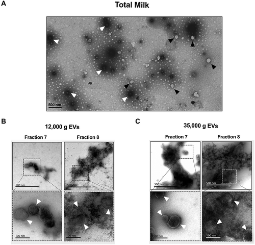 Figure 7. Transmission electron microscopy (TEM) analysis revealed that milk microRNA-enriched EVs are ~100 nm in diameter. (a–c) Whole milk (a) or IDG fractions F7 and F8 from 12,000 g (b) and 35,000 g (c) pellets were diluted 1:1000 in sodium cacodylate buffer, and layered on nickel-formvar grids for observation by TEM, after staining with aqueous uranyle acetate. The arrows indicate EVs.