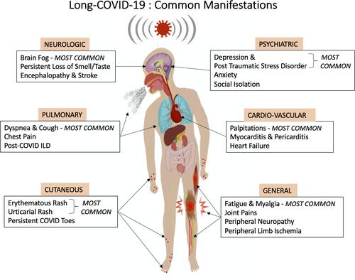 Figure 1 A pictorial illustration of the common clinical manifestations observed in Long-COVID-19.
