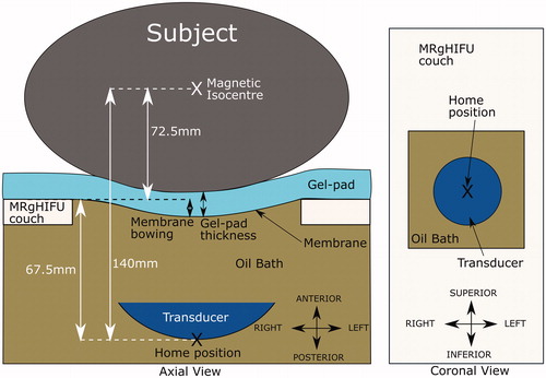 Figure 3. Schematic of the Sonalleve® V2 MRgHIFU system: LEFT - a subject lying on the MR bed will compress the acoustic-coupling gel-pad and bow the acoustic membrane, which seals the oil bath. Ideally, target tissue would be centered directly above the transducer’s home position and the center of the membrane/gel pad and below the magnetic isocentre. RIGHT- a coronal view of the MRgHIFU couch showing the transducer’s home position below the center of the membrane.