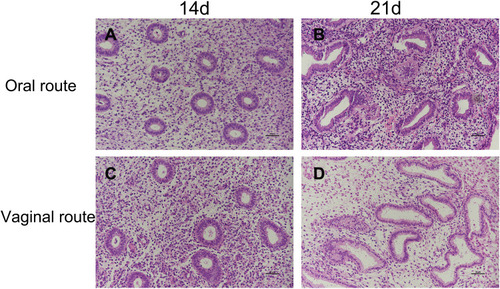Figure 1 Proliferative and secretory transformation of endometrium via the vaginal and oral route of estradiol and dydrogesterone (DG). Photomicrographs (×200) showing the amounts of glands in the vaginal group (C, D) were more than the oral (A, B). After 14 days of therapy, the vaginal group had pseudostratified columnar epithelium, curved glands, intercellular substance edema and spindle-shaped cells (C). On day 21 the vaginal group had bigger, curved, serrate glands, active apocrine secretion, large and round interstitial cells, apparent edema and glandular lumens existed secretions. After 21 days of therapy, the vaginal group had bigger, curved, serrate glands, active apocrine secretion, large and round interstitial cells, apparent edema and glandular lumens existed secretions.