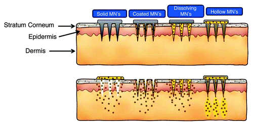Figure 4. Schematic representation of different types of microneedles (MN’s) used for the drug delivery (Reproduced with permission from ref. Citation54).