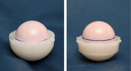 Figure 4. Difference in coverage of the Pinnacle’s and Continuum’s neutral liners. The same ceramic head was first placed in the Pinnacle’s neutral liner (left) and the line at the rim was marked with a pen. Then, the head was moved into the same-sized Continuum’s neutral liner (right).