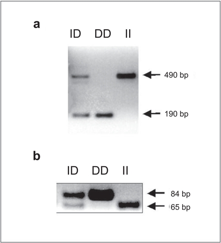 Figure 1 Determination of DD, ID, and II genotypes by PCR. Panel a shows a representative experiment using the method described by CitationRigat et al (1992). PCR products are a 190 bp fragment (D genotype) and a 490 bp fragment (I genotype). Heterozygotes (ID) have both the 190 bp and 490 bp fragments. Panel b shows a representative experiment using the method described by CitationEvans et al (1994). PCR products are a 84 bp (D genotype) and a 65 bp (I genotype). Heterozygotes (ID) have both the 84 bp and 65 bp fragments.