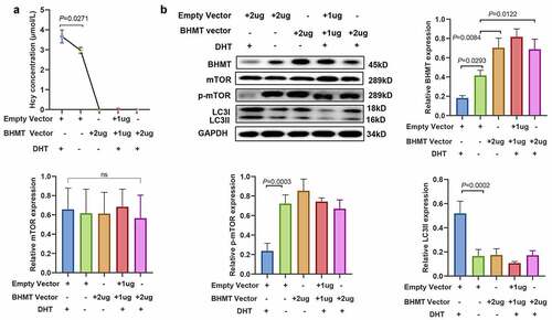 Figure 7. Betaine-homocysteine methyltransferase overexpression reverses dihydrotestosterone-induced homocysteine increase and autophagy activation. (a) Levels of homocysteine in mouse granulosa cells transfected with betaine-homocysteine methyltransferase overexpression plasmid and/or 1 µmol/L dihydrotestosterone, as determined by enzyme-linked immunosorbent assay. (b) Expression level of betaine-homocysteine methyltransferase, mammalian target of rapamycin, phosphorylated mammalian target of rapamycin, and light chain 3-II in mouse granulosa cells transfected with betaine-homocysteine methyltransferase overexpression plasmid and/or 1 µmol/L dihydrotestosterone, as determined by western blot analysis. Quantitative puncta analysis is presented on the right and lower panel, data are presented as mean ± SD, and experiments were repeated at least three times.