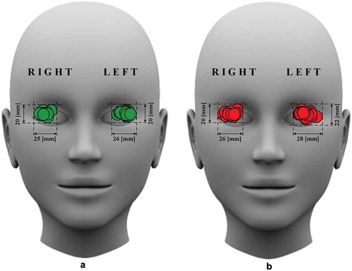 Figure 4. Relative positions of the ultrasonic transducer (UT) on the closed eyelid in the case of the located (a) intracranial segment of the ophthalmic artery simultaneously selected with the extracranial segment of the ophthalmic artery and (b) edge of the internal carotid artery. The width and height of the window within which the UT surface falls are indicated in millimetres.