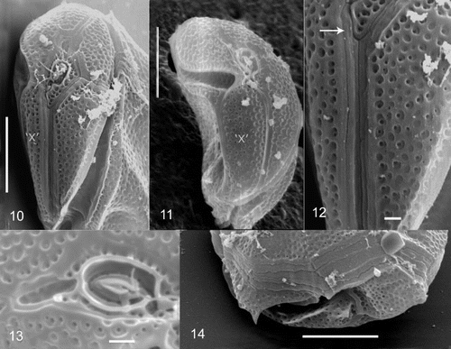 Figs 10 – 14. Cabra matta, gen. nov., sp. nov., SEM images. Fig. 10. Anterior view, showing epicone. Fig. 11. Anterior view, showing ‘x’ plate. Fig. 12. Anterior view of apical plates, arrow points to narrow first apical plate. Fig. 13. Apical pore and surrounding plates. Fig. 14. Lateral/posterior view, showing posterior plate. The ‘x’ plate is indicated for orientation purposes. Scale bars in 10, 11 and 14 represent 10 μm, and in 12 and 13, 1 μm.