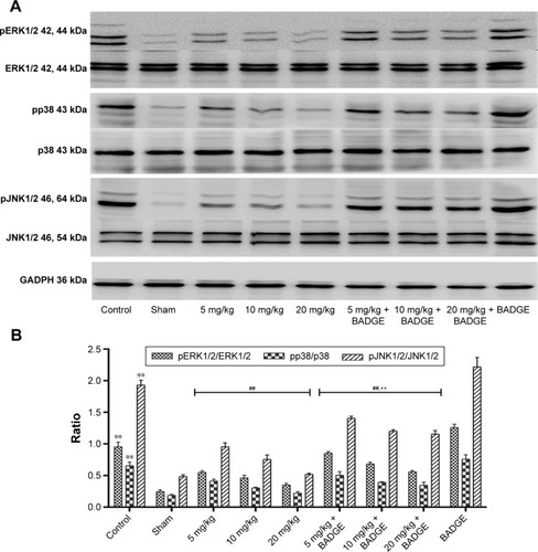 Figure 6 Effect of UA on the MAPK signaling pathway.