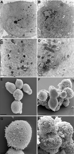 Figure 7 Morphologic analysis of stem cells derived from primitive fetal cells present in human amniotic fluid (hAFSCs) during HA + BU + RA-induced differentiation toward the cardiovascular phenotype. hAFSCs were cultured in the absence (A, C, E and G) or presence (B, D, F and H) of HA 2 mg/mL + BU 5 mM + RA 1 μM for 10 days. TEM analysis (A–D) or SEM analysis (E–H). (A) TEM imaging of untreated cells, 3,000x, scale bar 5 μm; (B) TEM imaging of HA + BU + RA-treated cells, 4,400x, scale bar 5 μm; (C) TEM imaging of untreated cells, 7,000x, scale bar 5 μm; (D) TEM imaging of treated cells, 12,000x, scale bar 1 μm; (E) SEM imaging of untreated cells, 1,600x, scale bar 10 μm; (F) SEM imaging of treated cells, 4,500x, scale bar 10 μm; (G) SEM imaging of untreated cells, 2,400x, scale bar 5 μm; (H) SEM imaging of treated cells, 8,000x, scale bar 5 μm. See text for more details.