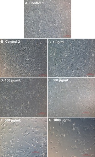 Figure 15 Phase contrast images of smooth muscle cells for the different doses of L-ascorbic acid (A–G) (scale bar indicates 100 μm).