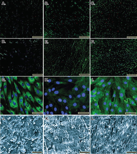 Figure 5. Cell viability was determined by live/dead cell assay using ﬂuorescein diacetate (live) and propidium iodide (dead). A to C. Rat fibroblasts that have been grown throughout the CI after 5, 10 and 20 days of cell seeding, respectively. D to F. Rat fibroblasts that have been grown throughout the collagen-platelet implant after 5, 10 and 20 days of cell seeding, respectively. The bovine xenogenous-based platelets in the collagen scaffold improved cell cytocompatibility of the implant because less dead cells (red) could be seen (D to F) when compared to the collagen scaffold alone (A to C). G to I. Fluorescence microscopy images of the fixed rat fibroblasts on culture medium, collagen scaffold and collagen-PG scaffolds, with rabbit anti-GRP 78 conjugated with Alexa 488 goat anti-rabbit (green)/DAPI (blue)-stained cells after 20 days of cell seeding and culture. J to L. SEM images of the rat fibroblasts cultured on culture medium, collagen scaffold and collagen-PG scaffolds after 20 days of cell seeding. Note that the PG enhanced cellular proliferation, maturation and matrix production. Scale bar: A to F: 100 µm, G to I: 25 µm and J to L: 50 µm.