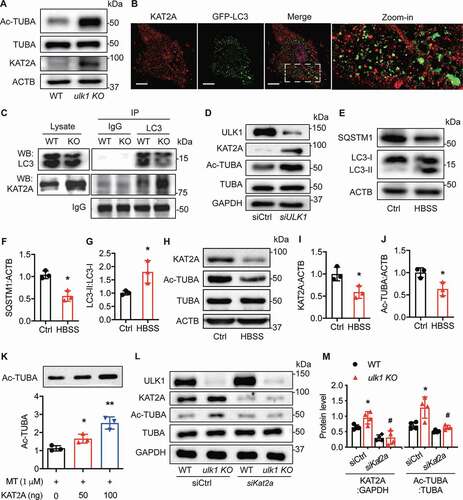 Figure 6. Ulk1 deletion leads to KAT2A accumulation that mediates the acetylation of TUBA. (A) Western blot analysis of the expression of KAT2A, TUBA, and Ac-TUBA in WT and ulk1 KO VSMCs, n= 6. (B) HASMCs were transfected with an adenovirus encoding GFP-LC3 for 24 h and then treated with chloroquine (CQ, 5 µM) for 16 h. KAT2A was stained by immunocytochemistry, and the co-localization (yellow) of KAT2A (red) and GFP-LC3 puncta was evaluated by immunofluorescence microscopy. Scale bar: 10 µm. (C) VSMCs isolated from WT or ulk1 KO mice were treated with CQ (5 µM) for 24 h and the interaction of KAT2A and LC3 were analyzed by immunoprecipitation (IP) and western blot (WB). (D) HASMCs were transfected with siCtrl (control siRNA) or siULK1 (ULK1 siRNA), and levels of ULK1, KAT2A, TUBA, and Ac-TUBA were measured by western blot. n = 6. (E-G) HASMCs were starved with Hank’s balanced salt solution (HBSS) for 3 h, and protein levels of SQSTM1 and LC3 were analyzed by western blot. n = 3, *P< 0.01 vs. Ctrl. (H-J) Levels of KAT2A, TUBA, and Ac-TUBA were measured using western blot. *P < 0.01, n = 3. (K) Purified porcine brain TUBA protein was incubated with recombinant KAT2A-catalytic domain protein in acetylation buffer at 37°C for 1 h. The acetylation of TUBA was assessed by western blot (n= 3, *P< 0.05, **P< 0.01). (L-M) WT and ulk1 KO VSMCs were transfected with siCtrl (control siRNA) or siKat2a (Kat2a siRNA) for 72 h, and protein levels of ULK1, KAT2A, TUBA, and Ac-TUBA were detected by western blot. * P< 0.05 vs. WT siCtrl, #P< 0.05 vs. ulk1 KO siCtrl, n = 4