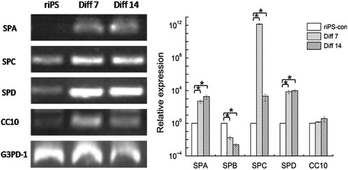 Figure 5. Specific gene expression of AT II epithelial cells. The gene expressions of specific markers of rat AT II epithelial cells are tested with RT-PCR. After differentiation, at stage 3, day 7 (Diff. 7) and stage 3, day 14 (Diff. 14), SPA, SPC, SPD, and CC10 were up-regulated compared with the riPS-con group, while SPB was down-regulated. Compared with the riPS-con group, *P < 0.05. 762 × 304 mm (300 × 300 DPI).