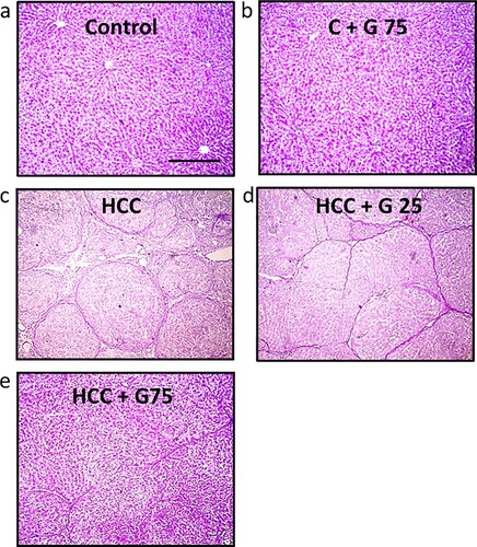 Figure 6. Hepatic sections stained with PAS stain. Livers in (a) the control group and (b) the control group treated with 75 mg/kg genistein displayed a healthy appearance. (c) HCC rats displayed a decreased positivity in staining compared with the control group. (d) HCC rats treated with 25 mg/kg genistein displayed a slight increase in staining positivity compared with the untreated HCC group. (e) HCC treated with 75 mg/kg genistein displayed a markedly increased staining positivity compared with the untreated HCC group. Scale bars, 100 µm. PAS, periodic acid Schiff; HCC, hepatocellular carcinoma.