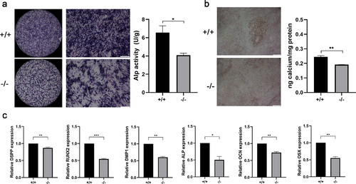 Figure 4. Mineralization assay. (a) Under induction with dental epithelium conditioned medium for 7 days, p75NTR+/+ and p75NTR−/−EMSCs were used for ALP staining assay. ALP activities of p75NTR+/+EMSCs was significantly higher compared with p75NTR−/− EMSCs. (b) p75NTR+/+ and p75NTR−/− EMSCs were used for Alizarin red staining. Calcium quantification illustrated the weaker calcium deposition in p75NTR−/− EMSCs compared with p75NTR+/+EMSCs. (c) The mRNA expression of DSPP, Runx2, DMP1, ALP, OCN and OSX were examined by RT-PCR. The data are presented as mean ± SD, n = 3, *P < 0.05, **P < .01, ***P < .001. Scale bar, 100 μm.