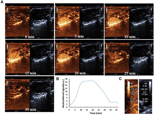 Figure 6 The stability of the GA/PLGA-CMBs under physiological condition. (A–C) each mouse was injected with 100 μL GA/PLGA-CMBs suspension via tail vein. In B mode and enhanced contrast mode, liver imaging was detected before and after injection of suspension. The in vivo imaging duration of GA/PLGA-CMBs was 30 min. n=3.