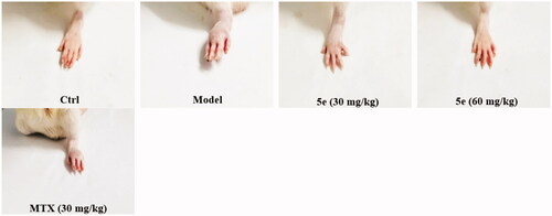 Figure 6. Establishment and treatment of CFA rat model of RA. Normal control group (Ctrl, saline), model group (Model, saline), high dose compound 5e (60 mg/kg) group, low dose compound 5e (30 mg/kg) group, positive control MTX (30 mg/kg) group. (n = 5 per group).