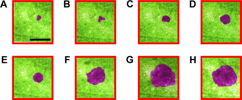 Figure S1 (A–H) False colored TEM images from Supplementary video 3 recorded for full fusion. Growth of insulin was reported at t: 0, 2, 4, 8, 16, 32, 64 and 120 seconds. Scale bar: 200 nm.Abbreviation: TEM, transmission electron microscopy.