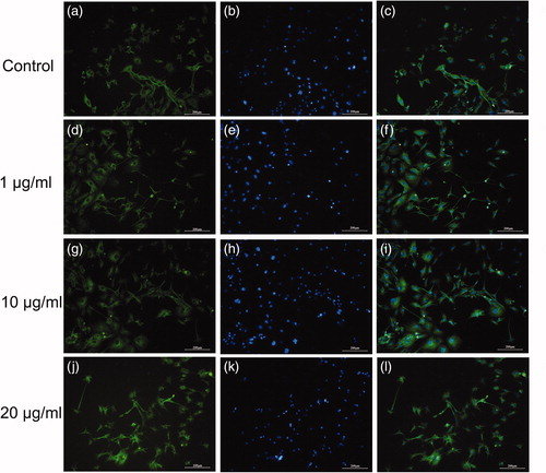 Figure 3. Effects of venom on differentiation of neural progenitor cells. β-Tubulin III (green) and nuclei (blue) in control cells (a–c), cells exposed to 1 μg/mL (d–f), cells exposed to 10 μg/mL (g–i) and cells exposed to 20 μg/mL (j–l) of crude venom. Note: Immunofluorescence images. Scale bars: 200 μm. C17.2 cells were exposed to either 1, 10 or 20 μg/mL of C. jingzhao crude venom in differentiation medium for 10 days.