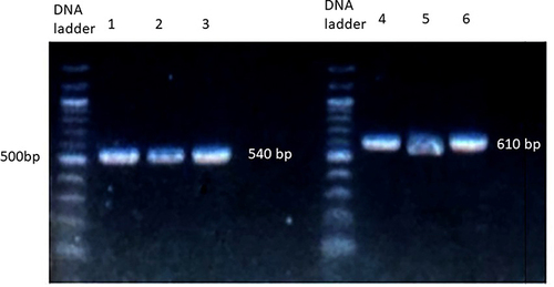 Figure 1 Gel electrophoresis of PCR amplification of the NAT2 gene. PCR products were run on 2% agarose gel stained with Redsafe stain. Lane 1–3 represents the amplification of the first, while lane 4–6 represents the amplification of the second part of the protein-coding region in NAT2 gene.