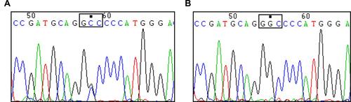 Figure 3 Sequencing analysis of the partial COL2A1 gene. The heterozygous c.611C>G, p.Gly204Ala mutation in exon 9 of the COL2A1 gene was shown in the affected family members (B) but not in the normal family members (A). The mutation site is marked by a filled black square and the mutant codon (GGC to GCC) is circled by a blank black square.