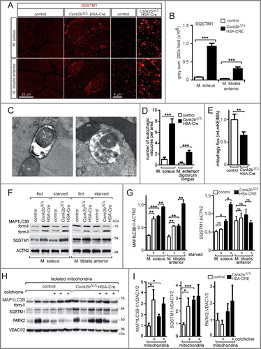 Figure 6. A block of mitophagy flux is involved in the accumulation of SQSTM1-associated cytosolic aggregates in csnk2b∆/∆, HSA-Cre muscles of adult mice. (A) Representative images of SQSTM1-immunostained soleus and tibialis anterior muscle cross-sections. High-resolution images of individual muscle fibers are shown on the right. Note, a higher number of SQSTM1-associated accumulations in cross-sectioned csnk2b∆/∆, HSA-Cre muscle fibers were visible. N = 3 mice per genotype. (B) Graph shows the quantification of grey sum fluorescence intensities of SQSTM1-immunostained cross-sections using ImageJ. (C) Representative electron microscopy images of csnk2b∆/∆, HSA-Cre muscle fibers showing autophagosomes containing mitochondria (capital ‘M’). Mitochondria outside of vacuoles are labeled by a lowercase ‘m’. (D) Autophagosomes were quantified in control and csnk2b∆/∆, HSA-Cre muscle fibers and are represented as a graph. N = 3 mice per genotype; 5 to 10 fibers were used for quantification for each of the muscles. Data are presented as mean ± s.e.m. (E) Flux of mitophagy was analyzed by electroporation of a reporter plasmid (mt-mKEIMA) into flexor digitorum brevis muscles of adult control and csnk2b∆/∆, HSA-Cre mice, changes of fluorescent spectra were detected and summarized by the presented graph. (F) Representative immunoblot images of muscle lysates from fed and starved adult 6- to 8-month-old control and csnk2b∆/∆, HSA-Cre mice. After SDS-PAGE and western blot, membranes were probed with antibodies labeling proteins implicated in autophagy, namely MAP1LC3B and SQSTM1. (G) Quantification of protein bands as seen in (F) using Image J. For normalization, ACTN2 was used. N = 3 mice per genotype. (H) Representative immunoblot images of mitochondria isolated from muscles from 3 different mice per genotype after colchicine treatment. After SDS-PAGE and western blot, membranes were probed with antibodies labeling proteins implicated in autophagy, namely MAP1LC3B-II, SQSTM1, and PARK2. Note, the increased amount of PARK2 refers to impaired mitophagy in csnk2b∆/∆, HSA-Cre muscles, while high amounts of SQSTM1, even in the absence of colchicine, indicate a block of mitophagy flux. (I) Quantification of protein bands as seen in (H) by ImageJ. VDAC1/2 served as a loading control.