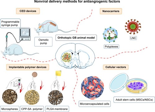 Figure 4 Nonviral delivery methods for antiangiogenic factors.Note: Four main nonviral methods have been developed to deliver angiogenesis inhibitors in orthotopic GB models: CED devices, implantable biodegradable polymer devices, nanocarriers, and cellular vehicles.Abbreviations: CED, convection-enhanced delivery; CPP, 1,3-bis[p-carboxyphenoxy] propane; GB, glioblastoma; LNCs, lipid nanocapsules; MSCs, mesenchymal stem cells; NSCs, neural stem cells; PLGA, poly([d,l]-lactide-co-glycolide); SA, sebacic acid.