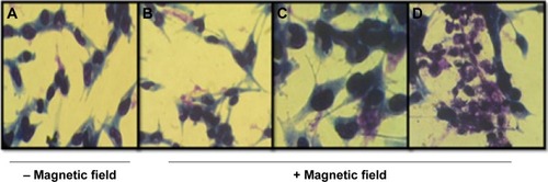 Figure 5 Images of B16F10 cells stained with H&E.Notes: (A) PBS; (B) pCEM-TRAIL; (C) pCEM-TRAIL, DogtorMag and magnetic nanoparticles; (D) pCEM-TRAIL, chitosan, and magnetic nanoparticles. Magnification ×200.Abbreviations: H&E, hematoxylin and eosin; PBS, phosphate-buffered saline.