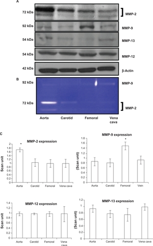 Figure 4 Differential expression A) activity B) and C) bar graphs of scanned intensity values of MMPs in different vascular beds. Western blot was performed to detect the MMP protein. The MMP-2 protein is expressed in a higher level in the aorta, whereas the MMP-9 protein is expressed in higher levels in the femoral artery, and the MMP-12 and MMP-13 protein not show any significant difference when compared with the other blood vessels.