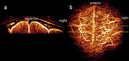 Figure 2. Maximum intensity projections (MIPs) of the 3D vascular network in the cat, viewed in (a) coronal (left image) and (b) axial orientations. The axial projection (b) was performed over the full acquisition volume; the coronal projection (a) was produced from a narrow slab indicated by the yellow lines in (b). The coronal view clearly shows the uniform organization of intracortical vessels. The axial view is dominated by the vessels on the pial surface. Adapted from ref 70: Bolan PJ, Yacoub E, Garwood M, Ugurbil K, Harel N. In vivo micro-MRI of intracortical neurovasculature. Neuroimage. 2006;32:62-69. Copyright © Academic Press 2006