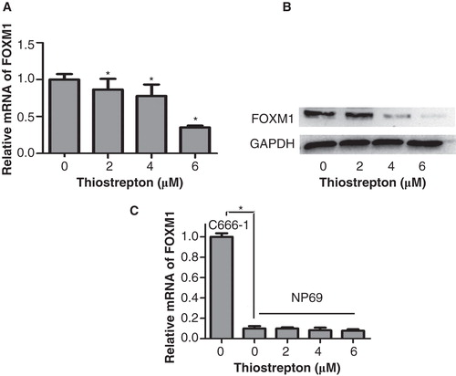 Figure 2. Thiostrepton significantly reduces the expression of FOXM1 mRNA and protein in a NPC cell line other than a nasopharyngeal epithelial cell line. A: The expression of FOXM1 mRNA in C666-1 cells was inhibited after thiostrepton treatment at 2, 4, or 6 µM for 48 h. B: Thiostrepton down-regulated the expression of FOXM1 protein in C666-1 cells. C: The expression of FOXM1 mRNA in NP69 cells was lower than in C666-1 cells and was less affected by thiostrepton. Experiments were independently repeated three times. *p < 0.05.