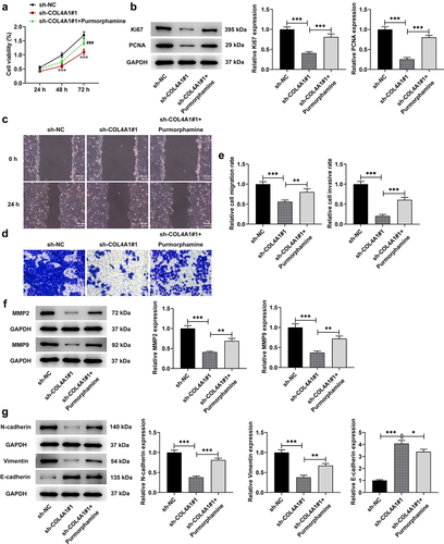 Figure 5. COL4A1 silence suppressed the malignant properties of MKN-45 cells via blocking Hedgehog signaling pathway. (a) The cell viability was detected using CCK-8. (b) Western blot tested Ki67 and PCNA protein levels. Cell migration and invasion were respectively evaluated by (c) wound healing and (d) transwell assays. (e) Western blot analyzed the protein levels of metastasis-related factors. (f) The expressions of EMT-related proteins were detected using Western blot.