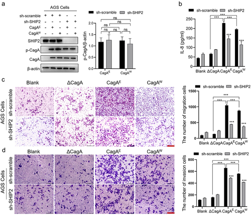 Figure 1. Pathogenic effect of H. pylori CagAE and CagAW mediated by SHIP2 in AGS cells.