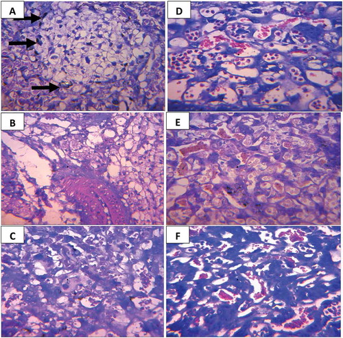 Figure 5. (a-f): Photomicrograph of cross histological section of the placenta from mice treated with different concentrations of M. lucida; (a-c) Infected mice treated with 100, 200 and 300 mg/kg body weight respectively. (d-f) Non-infected mice treated with 100, 200, and 300 mg/kg body weight, respectively. (a) Few trophoblastic cells that appear pyknotic in the infected-treated group (Long arrow). (b-f) No visible lesions in both infected and non-infected group, H and E × 400