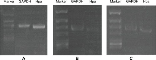 Figure 2 (A–C) Effect of Fe3O4-dextran-anti-β-human chorionic gonadotropin (HCG) carrying heparanase (Hpa) antisense oligodeoxynucleotide (ASODN) compounds on Hpa messenger RNA (mRNA) expression in JEG-3 cells. (A) Hpa mRNA expression in JEG-3 cells. (B) Hpa mRNA expression in JEG-3 cells after been treated with Fe3O4-dextran-anti-βHCG-Hpa ASODNs. (C) Hpa mRNA expression in JEG-3 cells after been treated with Fe3O4-dextran-anti-βHCG-Hpa NSODNs.Abbreviations: GAPDH, glyceraldehyde-3-phosphodehydrogenase; NSODN, non-sense oligonucleotides.