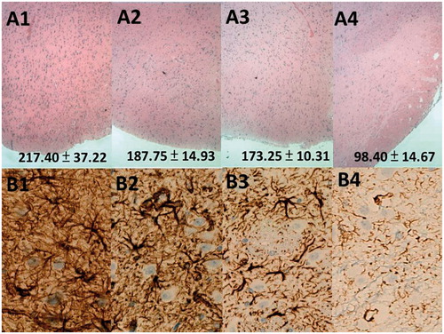 Figure 5. Pathologic examination of brain tissue samples at different time points. (A1–A4) The number at the lower right corner of each image indicates the estimated number of cells. No inflammation (achieved through the increased movement of plasma and leukocytes, especially granulocytes, from the blood to the injured tissues), tissue necrosis or dura mater thickening was observed in the haematoxylin and eosin histological examination. Progressive brain atrophy (decreased cellularity) was noted in serial histological examinations (magnification, 40×). (B1–B4) Glial fibrillary acidic protein Immunocytochemical examination revealed progressive decrease in the cellularity and destruction of the glial cells at subsequent experimental stages (magnification, 100×). (A1, B1: 2 weeks; A2, B2: 6 weeks; A3, B3: 10 weeks; A4, B4: 14 weeks after the implantation of the hybrid-structured poly[(d,l)-lactide-co-glycolide] nanofibrous membranes).
