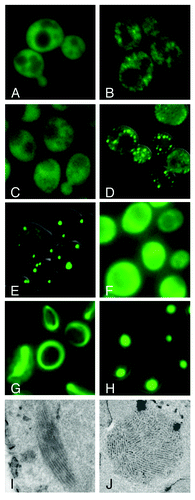 Figure 1. Different aggregation patterns of the fluorescently tagged Sup35 protein or the prion determining NM-region. (A, B) GFP was fused between the N and M domain of Sup35 and replaced with the endogenous SUP35 locus, expressed from endogenous Sup35 promoter, either in [psi-] (A) or [PSI+])B); (C-H) Fluorescence pattern of NM-GFP in cells deleted for the endogenous NM-domain in SUP35, expressed at different levels; (C) NM-GFP under control of the SUP35 promoter in the [prion-] state. (D, E) Clonal isolates of cells expressing NM-GFP from the SUP35 promoter after mating with a [PSI+] strain, sporulation and tetrad dissection; (F) [RNQ+] cells expressing NM-GFP constitutively from the GPD promoter, immediately after transformation with the expression construct; (G) [RNQ+] cells expressing NM-GFP constitutively from the GPD promoter, ~3–5 d after transformation with the construct, transitional induction state; (H) [RNQ+] cells expressing NM-GFP constitutively from the GPD promoter, ~10 d after transformation with the construct (mature prion state)Citation58; (I, J) Electron microscopy of ring and dot cells as in G and H, after fixation, staining with uranyl acetate and ultrathin-sectioning; (I) ring cell, (J) dot cell.Citation58