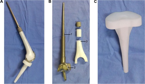 Figure 1 The prosthesis shown in its entirety, and then as components.