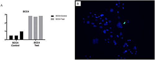 Figure 7. A&B: A, Graph showing SCC4 cell line subjected to tunicamycin-induced ER stress (test and control). B, Photomicrograph SCC cell line subjected to tunicamycin-induced ER stress with TUNEL staining. Blue = DAPI, Green = TUNEL. SCC4 cell line maintained cell viability in the presence of ER stress at a significantly greater level.
