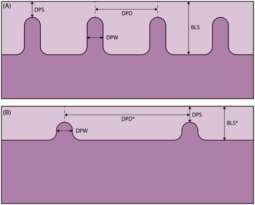 Figure 1. A schematic illustration of the vaginal wall in healthy women (A), and cervical cancer survivors with thin epithelia and sparse dermal papillae (B). Parameters measured in each specimen; DPS: distance from dermal papilla top to epithelial surface; DPD: interdermal papilla distance; DPW: dermal papilla width; BLS: distance from basal layer to epithelial surface and the number of the dermal papillae. *p value < .05