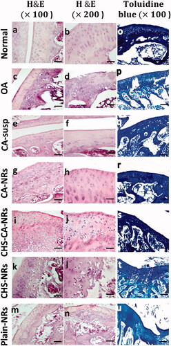 Figure 5. Histological analysis of cartilage sections stained with H&E (a–n) and toluidine blue (o–u) after 8 weeks of OA induction.