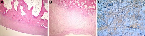 Figure 4 Histopathological appearance of cartilage formed in the HA group.