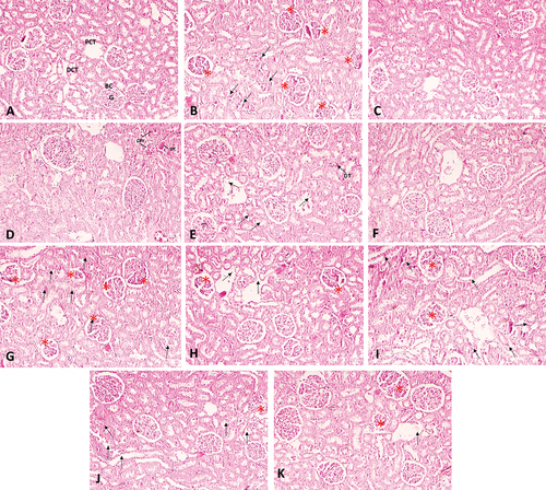 Figure 7. Representative images of A) histology of control rat kidney tissue; (B) kidney tissue of the lead-treated rat group showing severe atrophy of glomerular tufts with shrinkage and fragmentation (*), and desquamation and necrosis of tubular epithelial cells (arrow) therapeutic group: (C) NCDC-410 (D) NCDC-600; intervention group (E) NCDC-410 (F) NCDC-600; (G) kidney tissue of cadmium-treated rat group showing severe atrophy and degeneration of glomerular tufts with shrinkage, fragmentation and increased Bowman’s space (*), and desquamation and necrosis of tubular epithelial cells (arrow) Therapeutic; therapeutic group: (H) NCDC-410 (I) NCDC-600; intervention group (J) NCDC-410 (K) NCDC-600.
