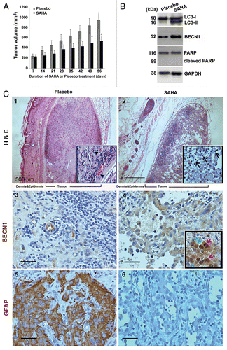 Figure 2. SAHA caused tumor growth slowdown and induction of autophagy in nude mice xenografts of GSCs. (A) The spheroid GSCs (1 × 106 cells) were mixed with 30 μl matrigels and inoculated subcutaneously into nude mice (n = 3 for each group). When the tumors reached 200 mm3 in volume, intraperitoneal injections of SAHA (100 mg/kg body weight) were administered every 24 h for 7 d and tumor volume was measured every 7 d after the cessation of treatment (mean ± SEM). There were highly significant differences at the end (day 49 and 56) of the treatment period (p = 0.031). “*” indicates significantly different from placebo group and p < 0.05 on Student’s t-test. (B) The protein expression levels of LC3 flux, BECN1 and PARP in xenograft tumor were determined by western blotting. GAPDH was a loading control. (C) Top panels: Hematoxylin-eosin staining of a representative section. Xenograft tumor initiated from GSCs exhibited morphologic characteristics of glioma, including marked cellular pleomorphism, large, round nuclei prominent nucleoli, abundant cytoplasm and vasculogenic tubular formation (black arrowheads; placebo, left upper panel), whereas there were significant decreases in tubular structures and increases in differentiated cells in the SAHA treatment (SAHA, right upper panel). Note the presence of vacuolated cytoplasm, fragmented tumor cells, and isolated nuclei of tumor cells characterized by dense eosinophilic cytoplasm and hyperchromatic nuclear fragments (marked by black arrows). Center and bottom panels show the immunochemical staining results for the autophagy BECN1 marker and diagnostic marker of GBM: GFAP. Immunohistochemistry detected BECN1 rarely and, when found, only surrounded the vascular-like channel structures (placebo, center left), whereas the section of SAHA treatment revealed diffuse staining of BECN1 in necrotic parts of the tumor cell cytoplasms, and at the perinuclear region (red arrows), with a relocation of BECN1 around the nucleus (green arrowheads) and at the frontier of the necrotic part of some cells (center right). Bottom panels show the protein expressions of GFAP that served as diagnostic controls. Insert panels show a higher magnification, and each square represents 100 × 100 μm. Scale bars: 500 μm (upper panels) and 50 μm (center and bottom panels).